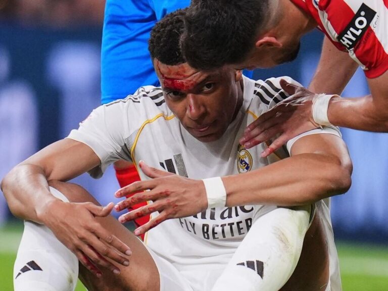 Kylian Mbappé im Trikot von Real Madrid fasst sich nach einem Foulspiel schmerzverzerrt an den Kopf.